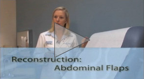 abdominal-flaps