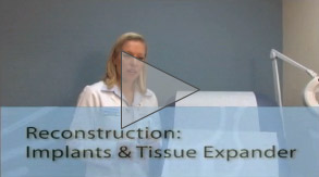 Tissue-Expander-Implant-Consultation-Video