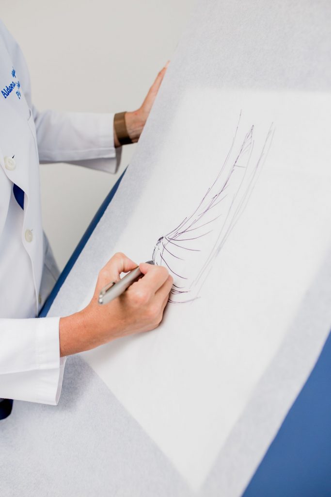 Dr. Spiegel Illustration of Breast